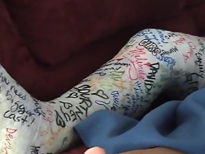 leg Cast